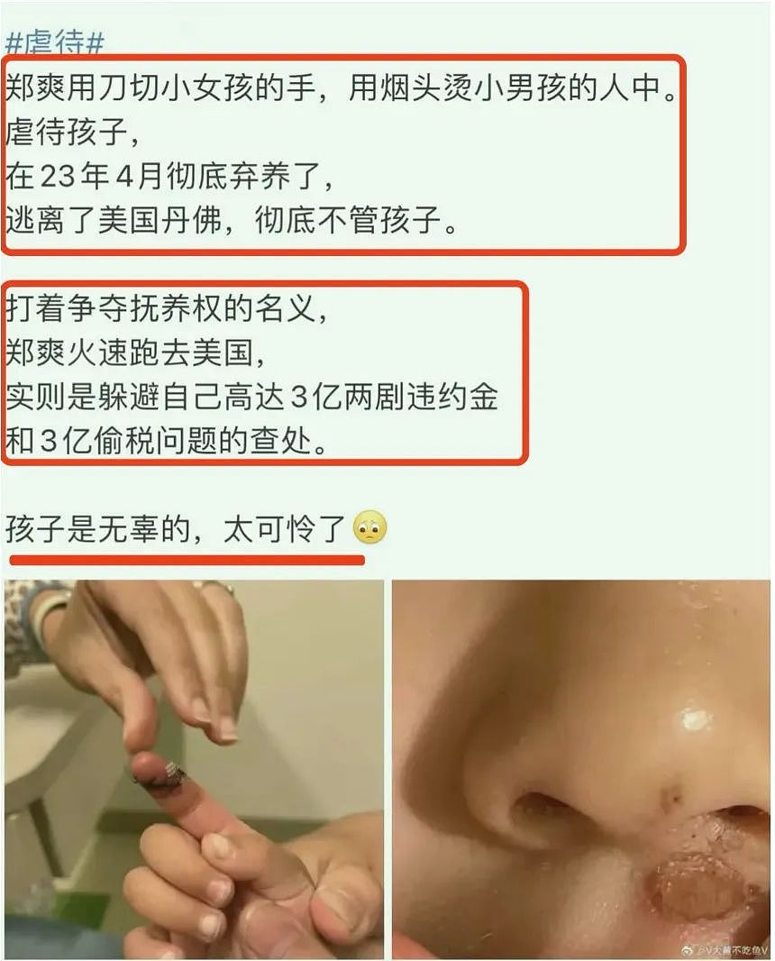 郑爽近照曝光！当小三、黄发秃顶、身体发福！网友：白月光已死…..（组图） - 2