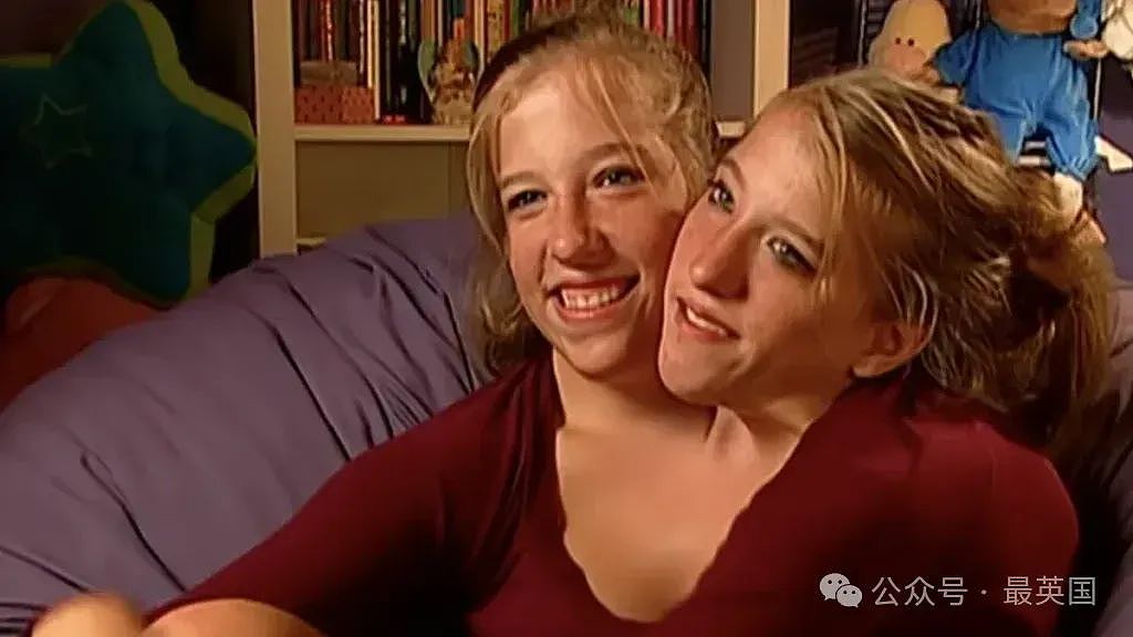 美国34岁连体姐妹宣布已婚，开启三人生活还有娃！双头共用一个身体，如何共享亲密惹争议…（组图） - 11