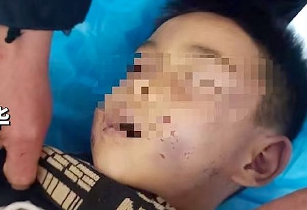 生母继父下毒手？中国5岁男童暴毙，爷爷痛诉：胸部被打出一个坑洞（组图） - 2