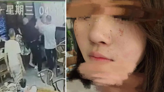 满脸是血，差点儿毁容！四川两名16岁女生拒陪酒遭被殴打；警方通报：一男子被刑事拘留（视频/组图） - 2
