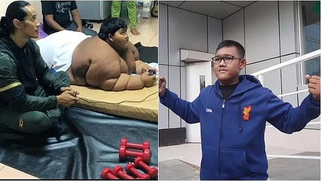 “全球最胖男孩”17岁了，减轻200多斤后爱运动，可惜疤痕太醒目（组图） - 4