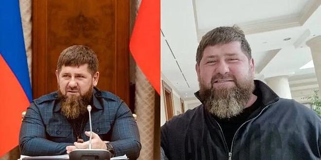 47岁车臣领导人被曝“胰腺坏死”，没有康复希望，已从强壮变臃肿（组图） - 4