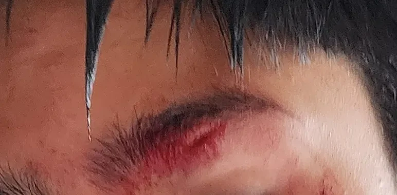 新西兰14岁华人男生坐公交，遭4名teenager殴打，血流满面！车上无一人帮忙（组图） - 2
