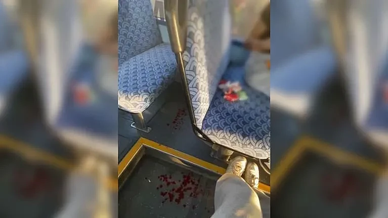 新西兰14岁华人男生坐公交，遭4名teenager殴打，血流满面！车上无一人帮忙（组图） - 5
