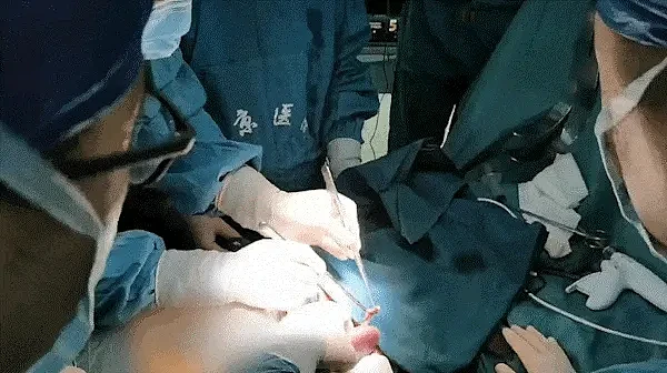大突破！术前仅有几周生命，54岁女病人“猪肾和人工心脏联合移植手术”完成，其丈夫：重新看到了妻子的笑容（组图） - 4