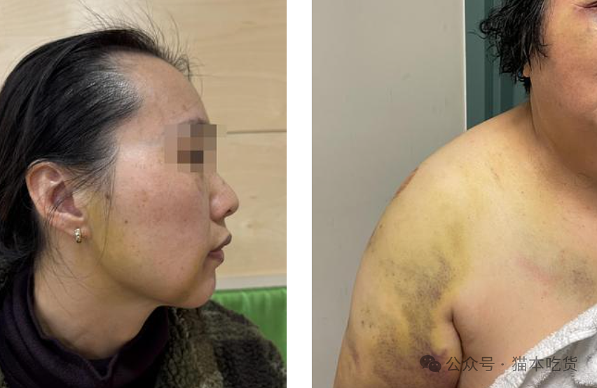 滚回中国”！墨尔本华女携母亲及4岁女儿出游，停车场内突遭恶毒殴打！72岁老人被打成重伤（组图） - 2