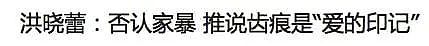 天！大肚子去美国生娃，被老公家暴4次，不敢说…（组图） - 20