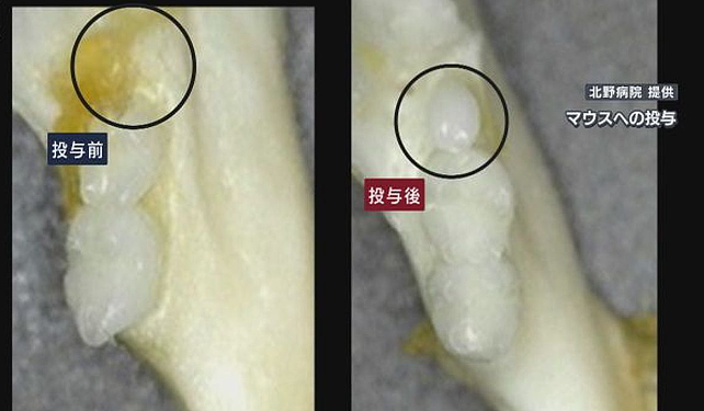 人类新突破！日本医疗团队研发出一种新药：可以长出“第三颗牙齿”（组图） - 3