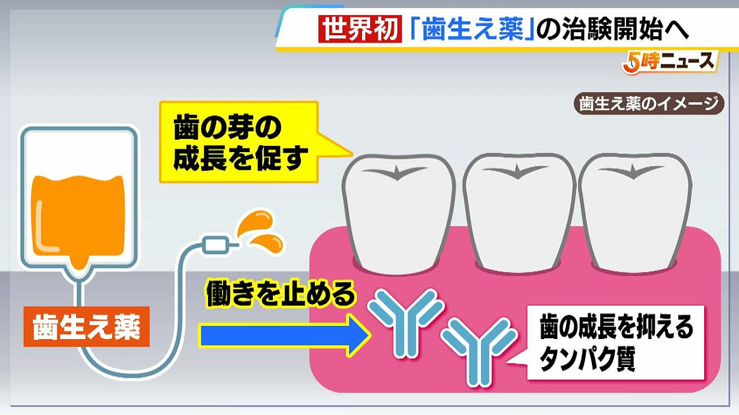 人类新突破！日本医疗团队研发出一种新药：可以长出“第三颗牙齿”（组图） - 4