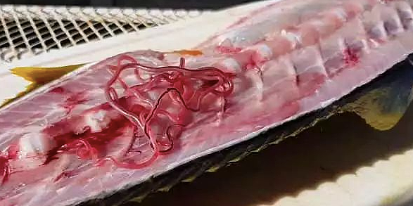 澳洲常见鱼类“暴雷”，含大量寄生虫，画面太恶心！已有患者染病，痛到肌肉像被撕开，恐落下终生残疾（组图） - 11
