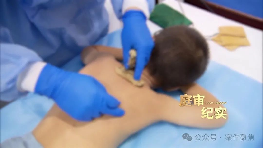 上海一2岁男童反复高烧，家长死活不送医院？肺部被诊断“严重受伤”，差点出大事...（组图） - 9