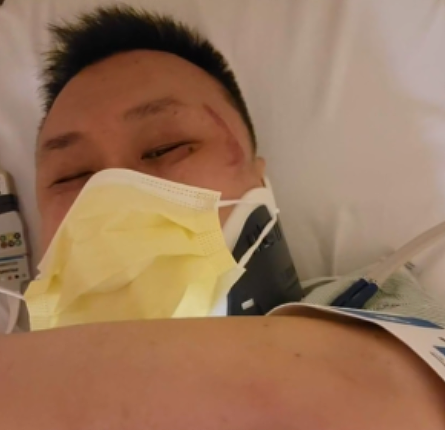 可怕！41岁华裔男子逛超市，遭近10人围殴打成脑震荡，当场昏厥（组图） - 3