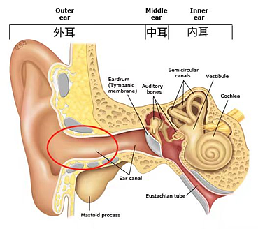 耳朵总是痒，却啥也掏不出来？可能暗示这 5 种问题，快自查（组图） - 2