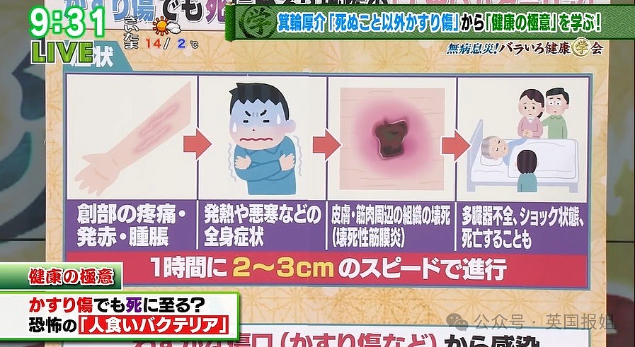 “夺命食人菌”攻占日本？致死率高达30%，半年感染人数大破记录！（组图） - 3