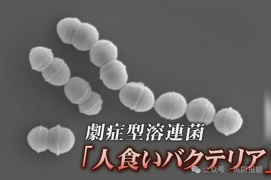 “夺命食人菌”攻占日本？致死率高达30%，半年感染人数大破记录！（组图） - 10
