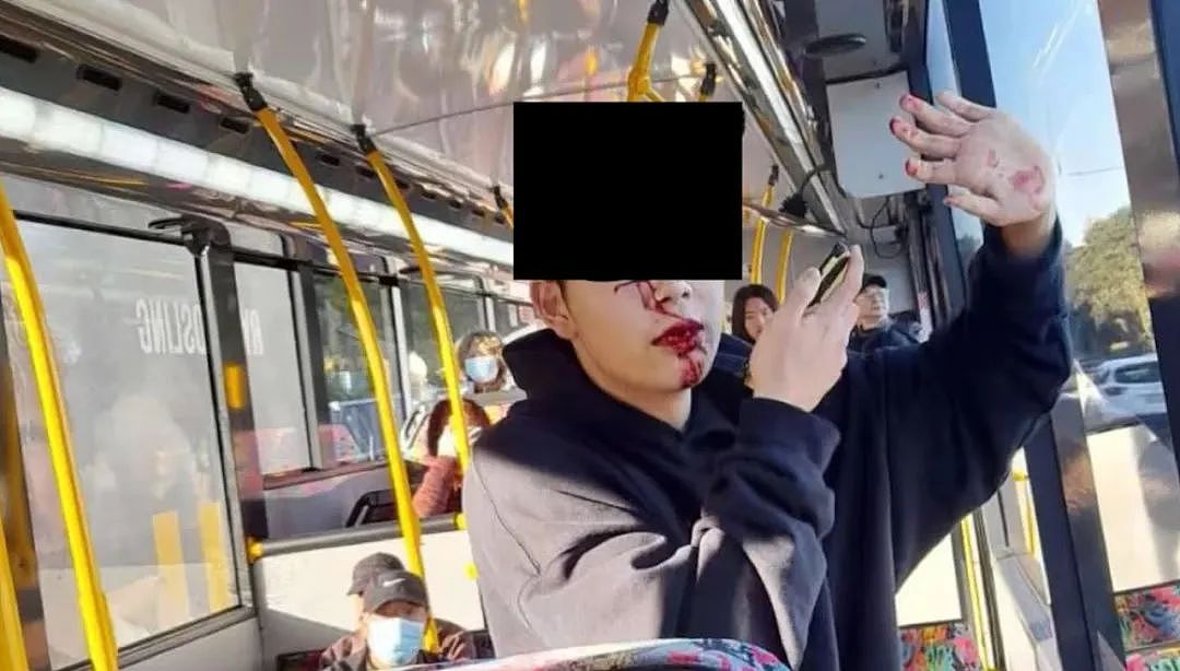 华人少年公车上遭西人女子铁棒袭击，三颗牙齿被打掉！司机纵容罪犯逃离，大使馆紧急提醒（组图） - 6