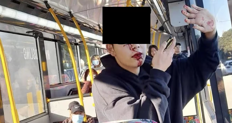 热议：华人男子公交车上，被白人打掉牙！10+名同胞却冷眼看，只有75岁华人大爷忍不了了（组图） - 3