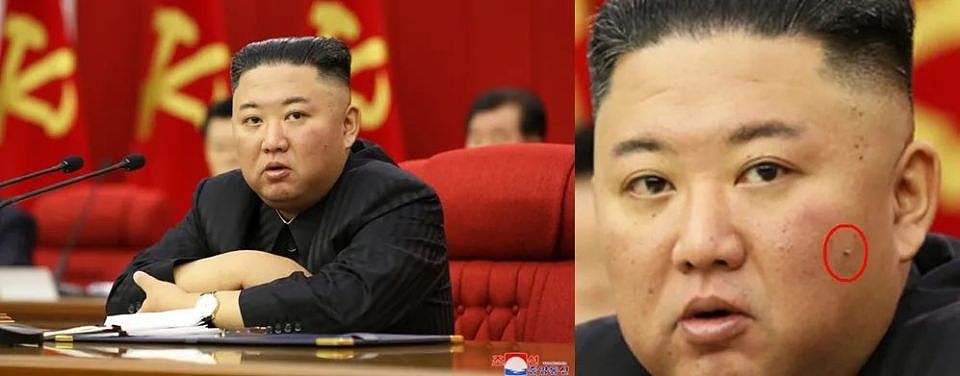 金正恩的脸上究竟长了一颗什么东西？（组图） - 13