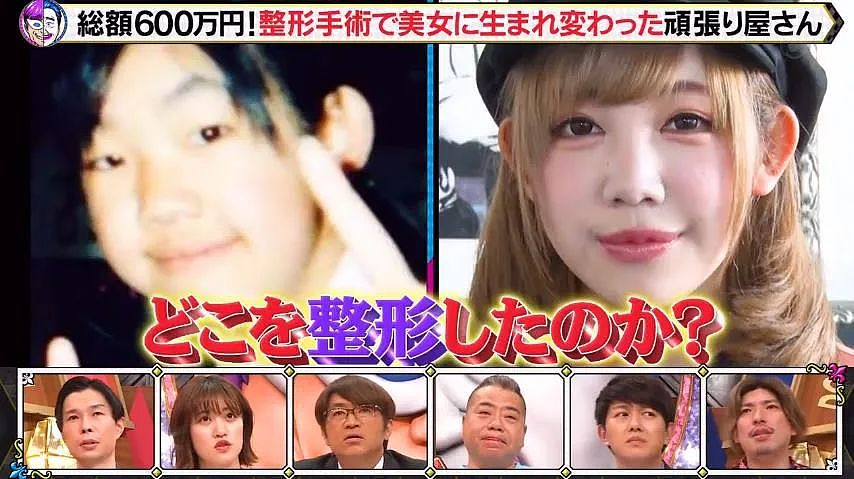 日本33岁正妹偶像19岁开始，被妈妈支持整容，十年花费600万日元！结果让网友痛哭…（组图） - 3