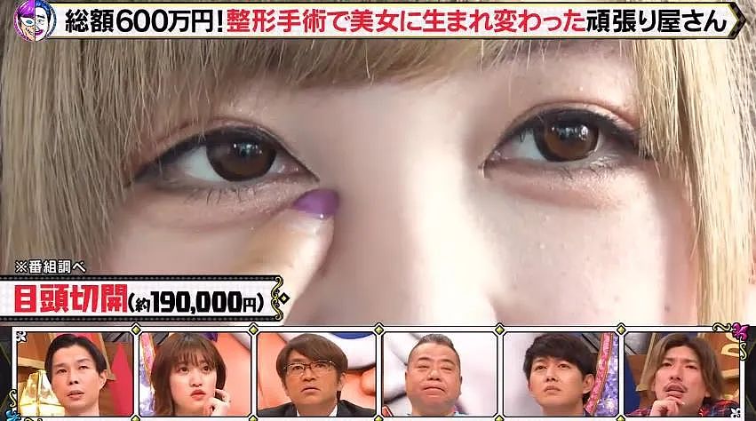 日本33岁正妹偶像19岁开始，被妈妈支持整容，十年花费600万日元！结果让网友痛哭…（组图） - 9
