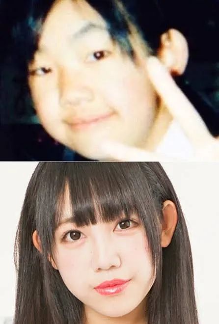 日本33岁正妹偶像19岁开始，被妈妈支持整容，十年花费600万日元！结果让网友痛哭…（组图） - 16