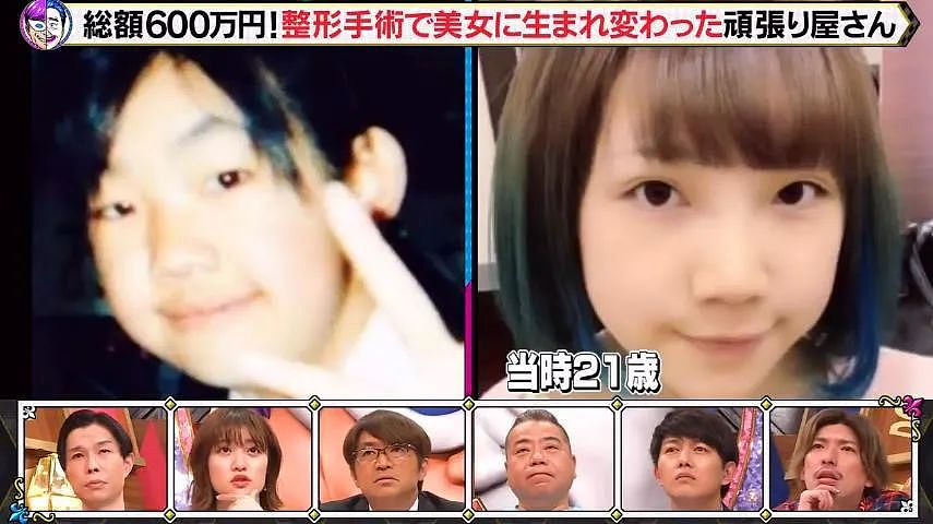 日本33岁正妹偶像19岁开始，被妈妈支持整容，十年花费600万日元！结果让网友痛哭…（组图） - 2