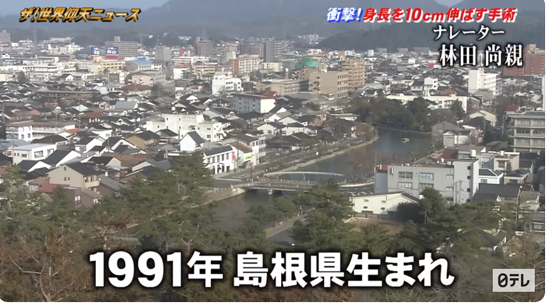 男子约会外国妹子被身高打击，远赴海外反复“断骨”只为增高10cm！（组图） - 2