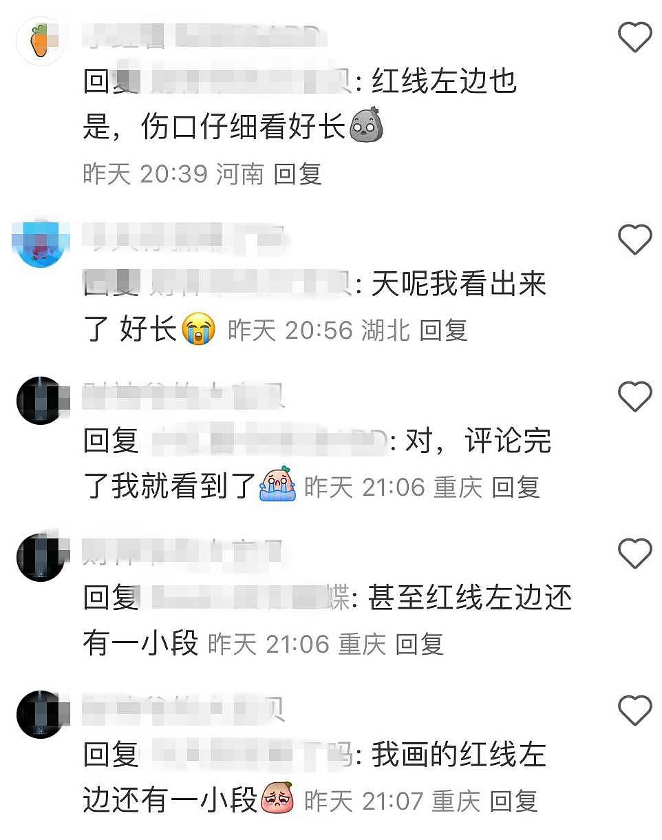 陈奕迅受伤一个月首露面，深见骨的下巴伤口变成长疤痕，恢复情况曝光（组图） - 10