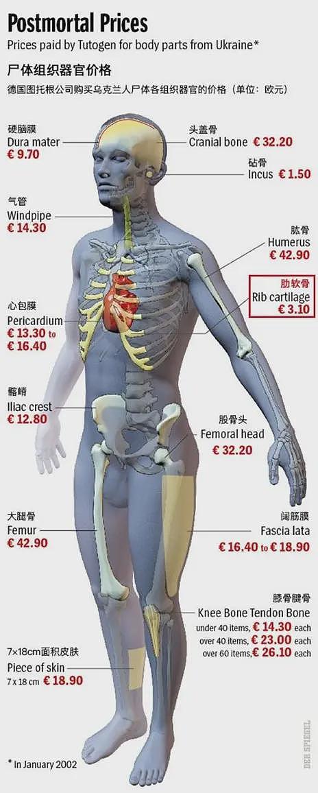 “异体骨”用于何处？有哪些传染风险？建议立法重罚尸体倒卖（组图） - 11