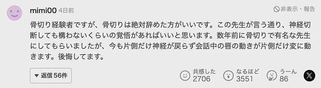 日本小哥为整成“日本第一小脸”斥资4000万削骨抽脂，却遭网友吐槽辣眼睛（组图） - 16