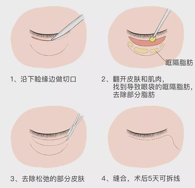 封神“最美妲己”断崖式衰老！为什么娜然的花期这么短？（组图） - 14