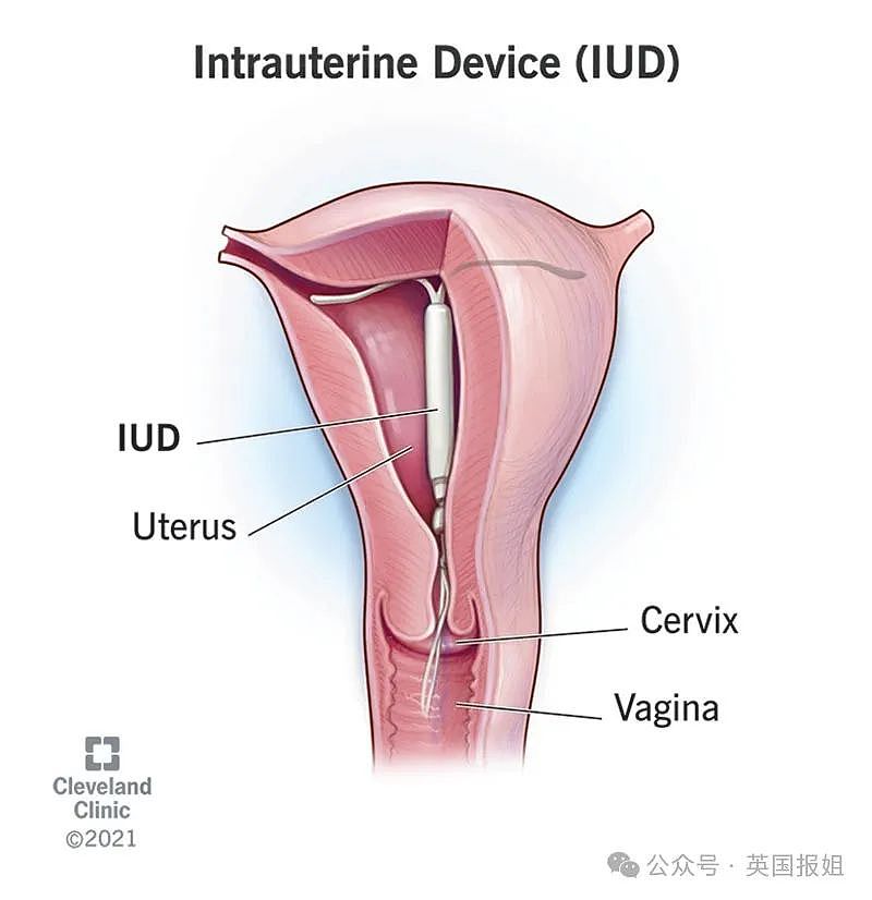 可怕！女子对月经过敏，每来一次全身都起严重红疹？“像100万只蚂蚁在我身上爬”（组图） - 7