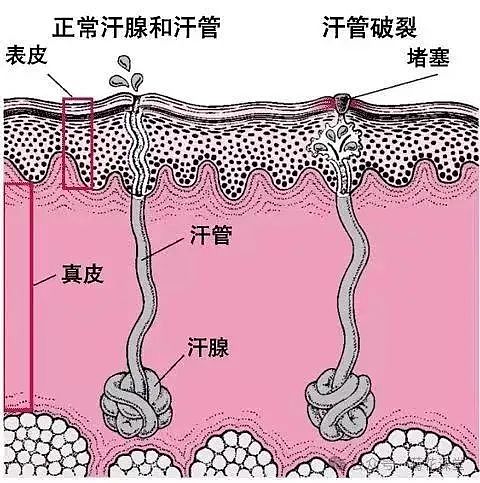 妻子总嫌他那里滂臭，一查真有大病！有人羞耻不去看，拖久了可能要命（组图） - 4