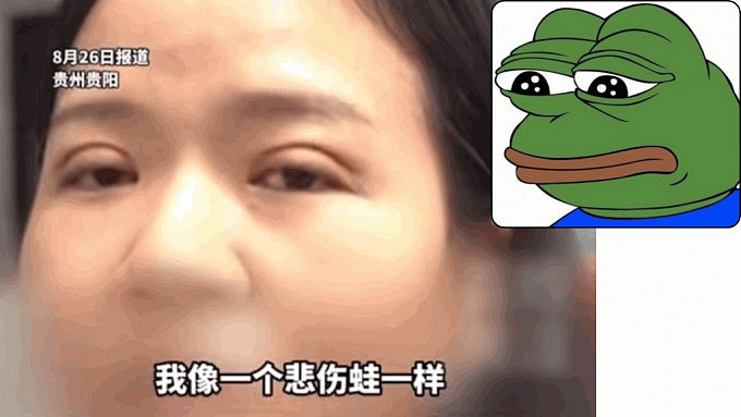 整容变毁容！贵州女斥2万割双眼皮，惨变“Pepe蛙”（组图） - 1