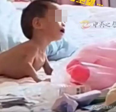 虐待疑云：1岁幼儿饿至皮包骨仅约2.5KG！生父：养不起希望能活到下去（组图） - 2