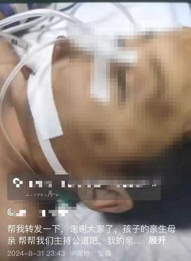 3岁幼童疑遭虐待进ICU，诊断已脑死亡，警方：生父女友被刑拘（图） - 1