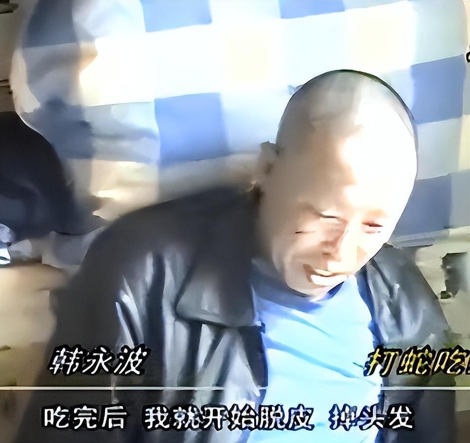 辽宁男子捕蛇吃蛇变“蛇人”，浑身脱皮长满鳞片，难道是诅咒（组图） - 7