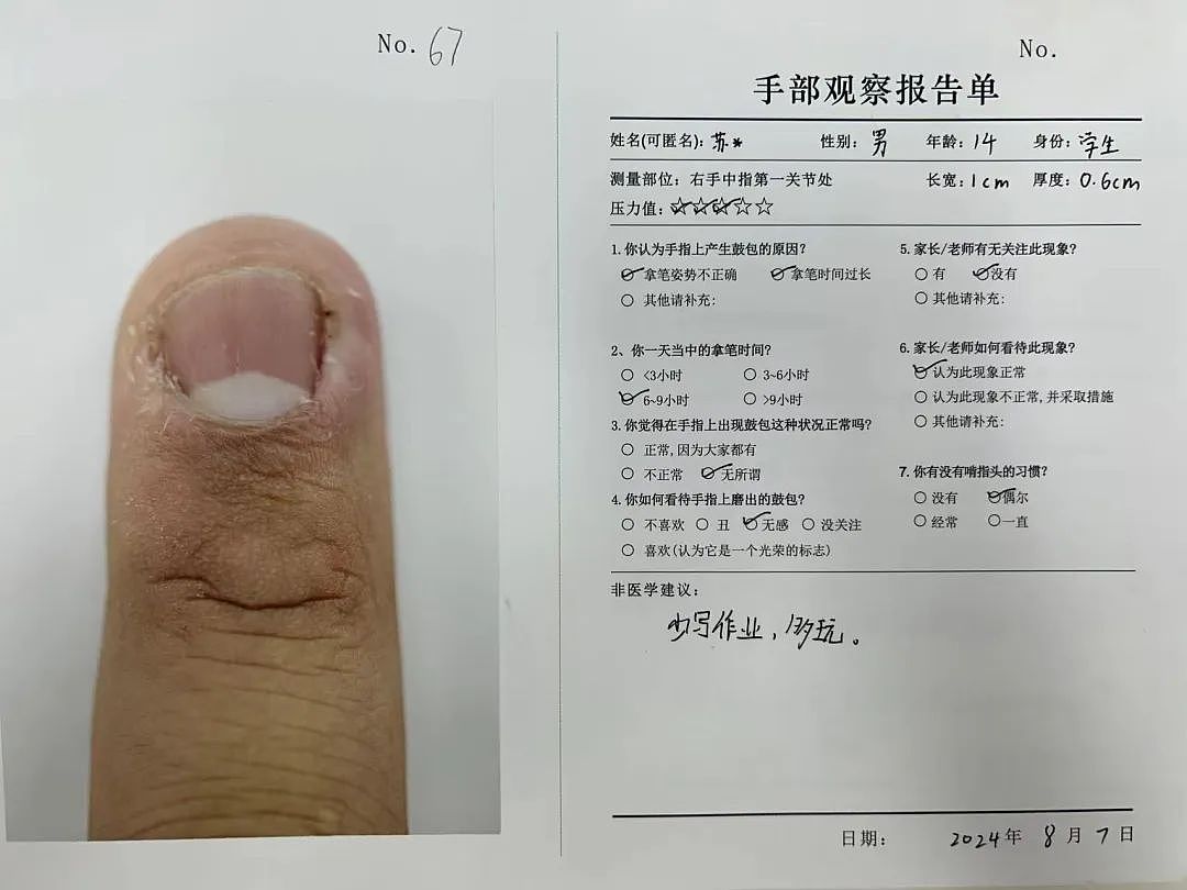 一个高中生和她拍下的117根手指，因刷题太多而变形（组图） - 12