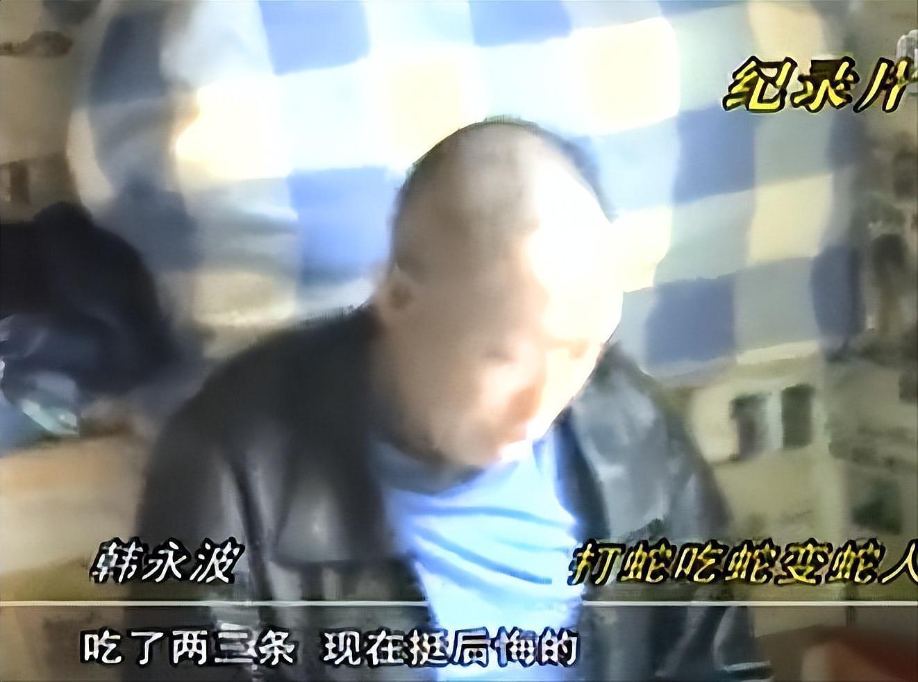 辽宁男子捕蛇吃蛇变“蛇人”，浑身脱皮长满鳞片，难道是诅咒（组图） - 4