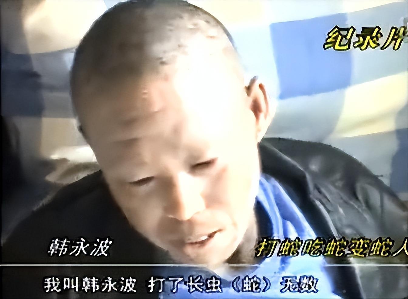 辽宁男子捕蛇吃蛇变“蛇人”，浑身脱皮长满鳞片，难道是诅咒（组图） - 3