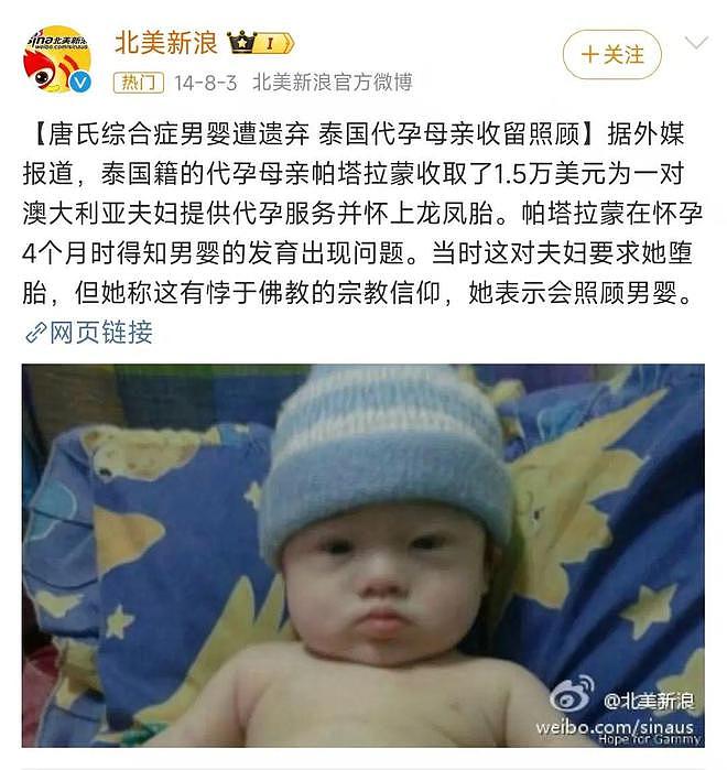 澳洲夫妇找亚裔女子代孕龙凤胎，10个月后，健康女婴被带走，唐氏男婴遭遗弃（组图） - 3