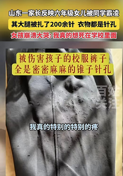 济南小学生被同桌扎218针，学校回应全网暴怒：看完细节，令人痛心（组图） - 5