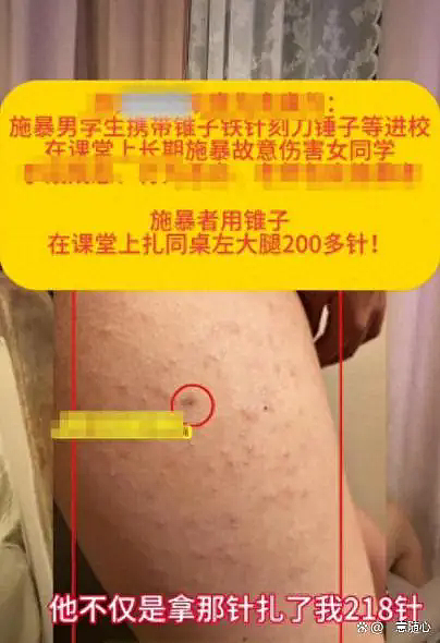 济南小学生被同桌扎218针，学校回应全网暴怒：看完细节，令人痛心（组图） - 4