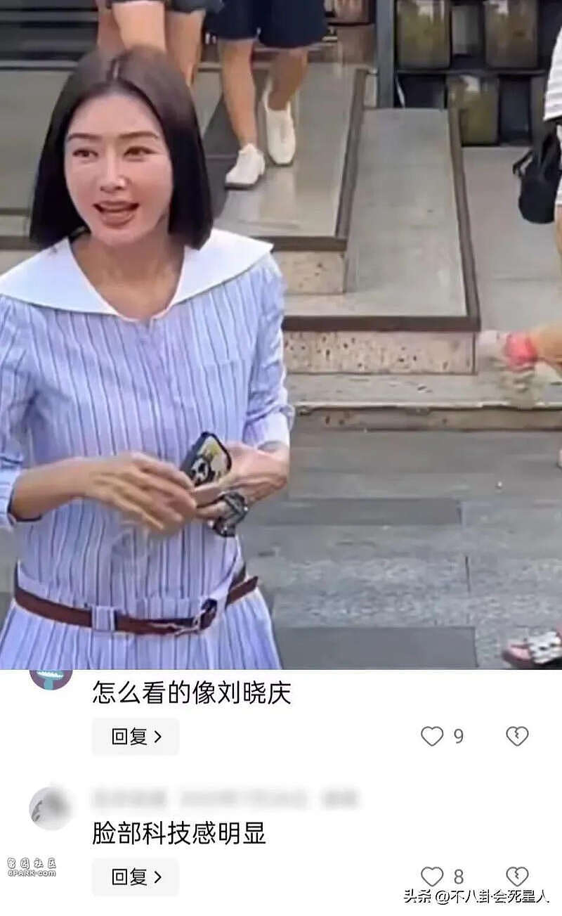 嘴唇变厚脸僵浮肿，近照曝6位中年女星医美后遗症（组图） - 10