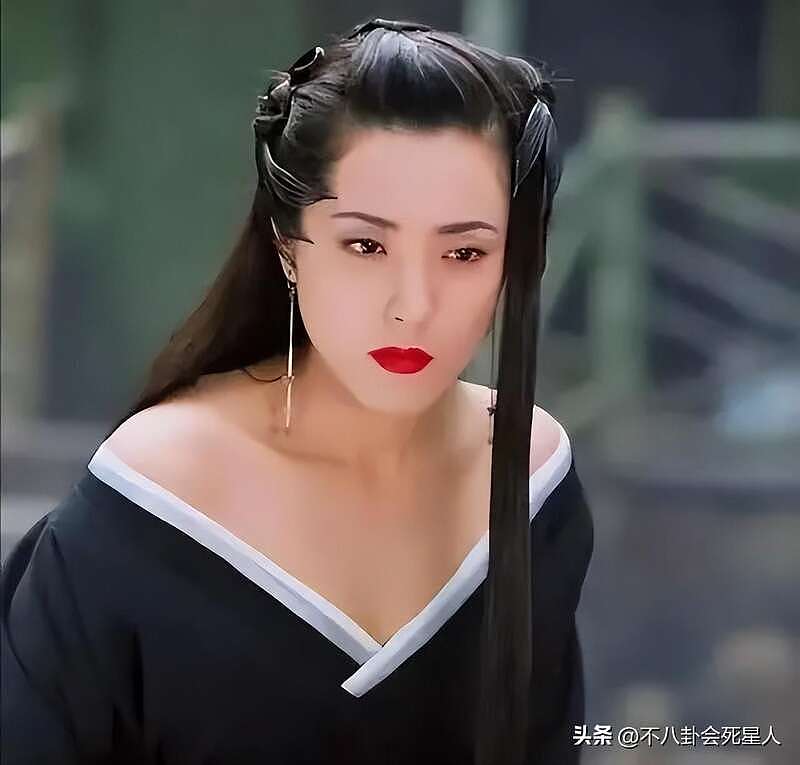 嘴唇变厚脸僵浮肿，近照曝6位中年女星医美后遗症（组图） - 11