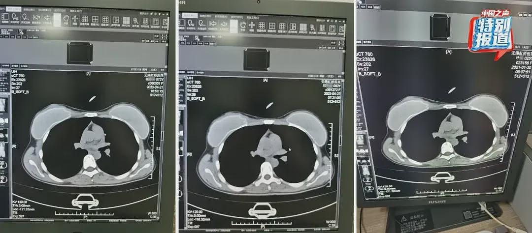 国家医保局出手，无锡虹桥医院被查！背后资本集团投资8家医院，旗下医院多次被罚（组图） - 4