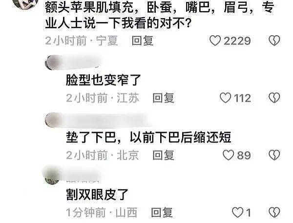 46岁海清近照变样，45岁秦岚生图脸僵，中年女星动脸也疯狂（组图） - 6