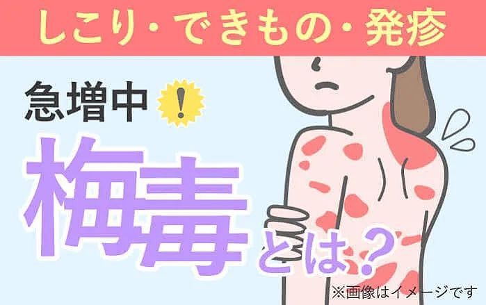 中国游客在日本找刺激买春下场超惨！30岁金融男嫖一次染两种性病（组图） - 12