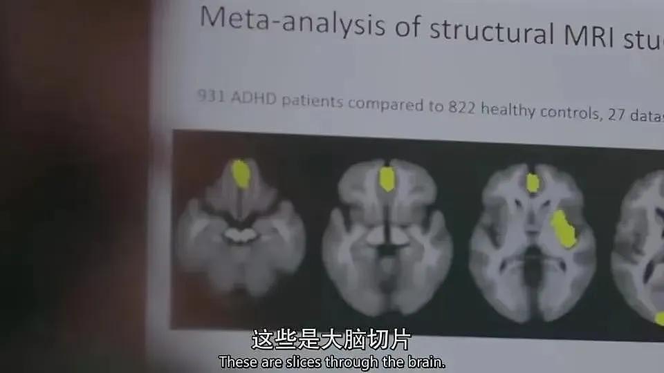 中国有2000万孩子得了这个病，比抑郁症更可怕（组图） - 11