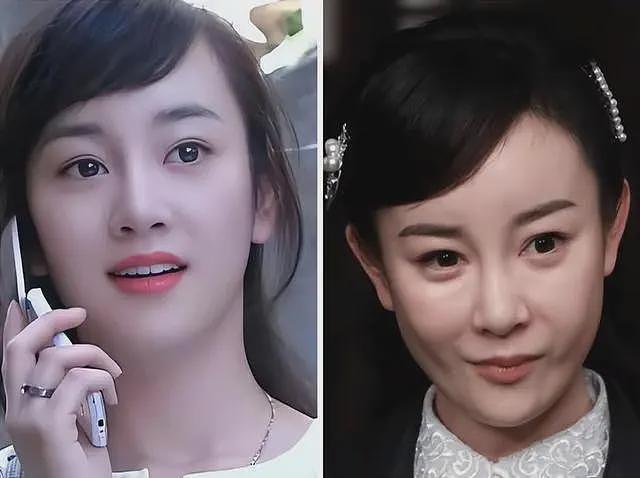 葬送前途也要整容，这10位“面目全非”的女星，肠子都悔青了（组图） - 42